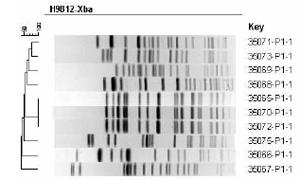 Pulsed-Field Gel Electrophoresis